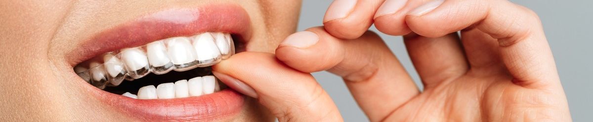 Antonio Cerezuela Odontología - ACO recorte mujer colcandose dentadura